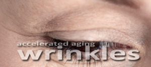 Sun damage in early life leads to aging wrinkles at a premature rate.